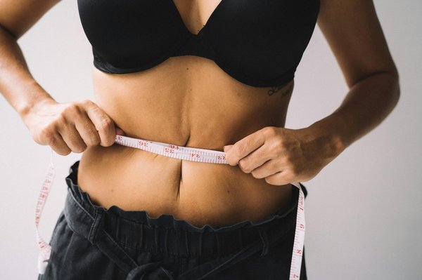 Diastasis Paris : solutions pour retrouver un ventre plat